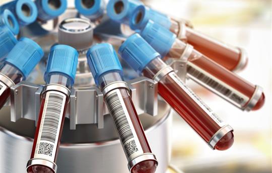 centrifuge holding vials of blood with blue caps and barcode labels